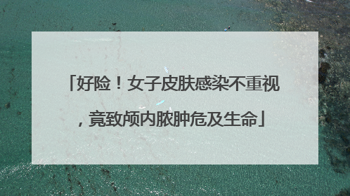 好险！女子皮肤感染不重视，竟致颅内脓肿危及生命